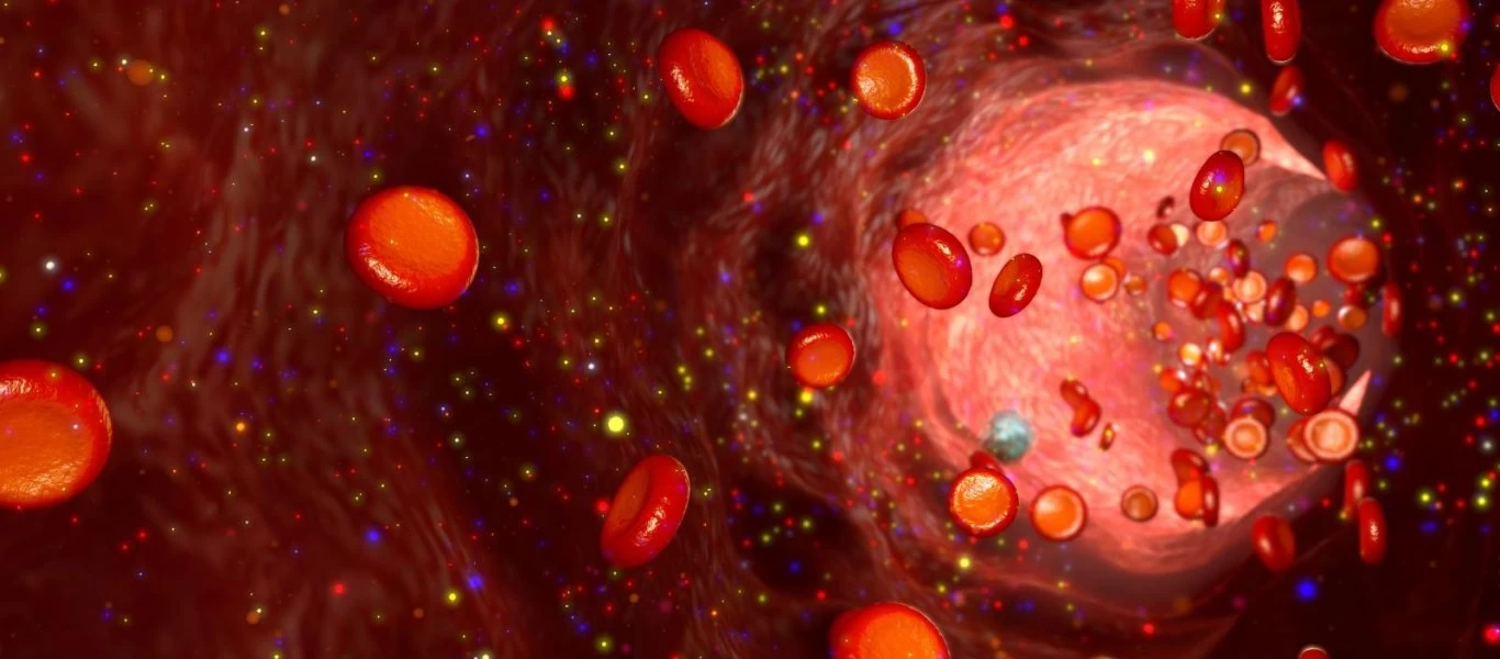 Οι Κουβανοί μετέφεραν στην Ιταλία το φάρμακο Alfa 2B το οποίο δοκιμάστηκε (επιτυχώς) κατά του κορωνοϊού στην Κίνα